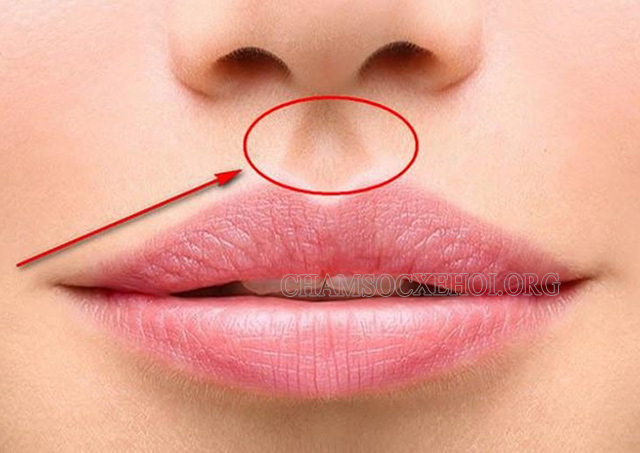 Nhân trung là gì? Nhân trung sâu tốt hay xấu ???