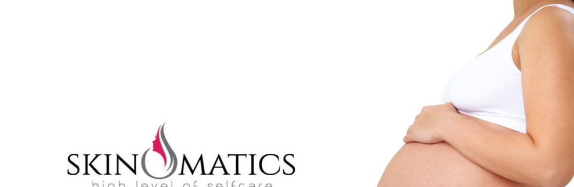 skino matics Cover Image